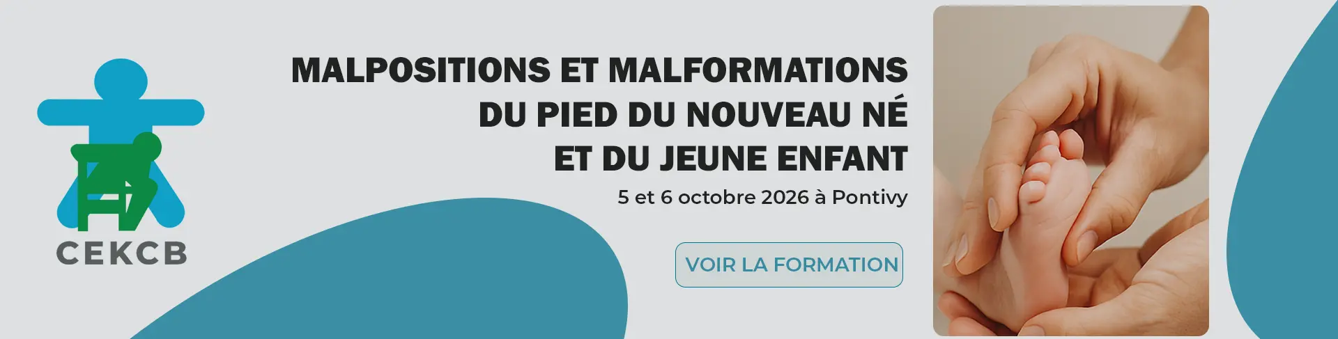 Malpositions et malformations du pied du nouveau né et du jeune enfant