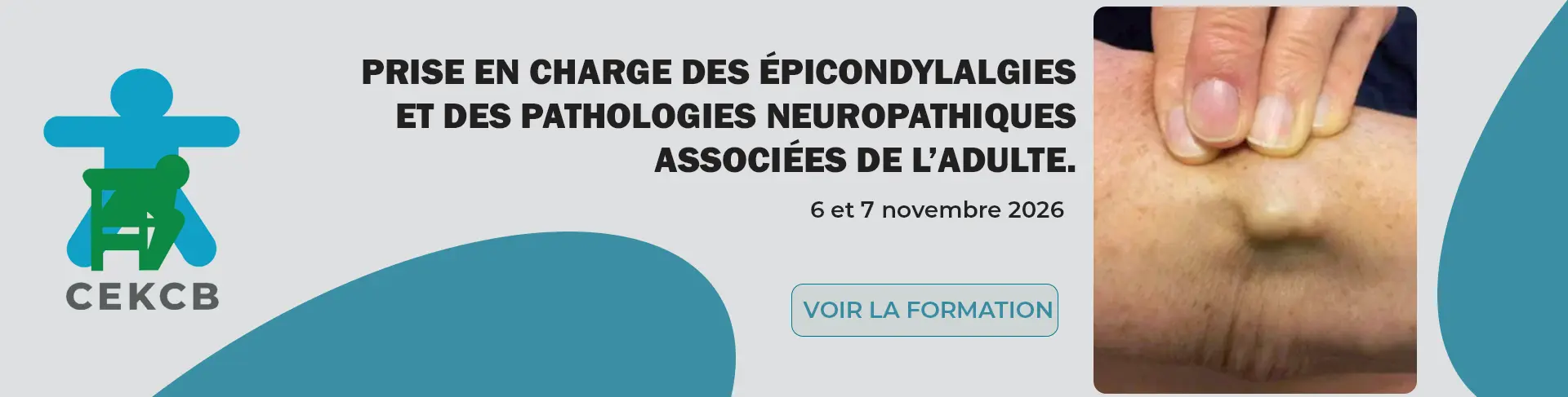 Prise en charge des épicondylalgies et des pathologies neuropathiques associées de l’adulte.